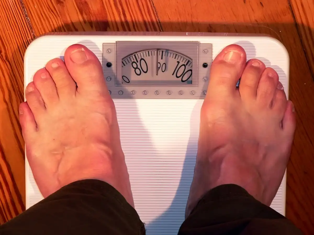 Peneliti Ungkap: Anak Muda Rentan Kematian Akibat Obesitas dan Diabetes