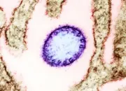 Virus Nipah Kembali Serang India, Ancaman Mematikan dengan Risiko Kematian Tinggi