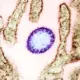 Virus Nipah Kembali Mewabah di India, Risiko Kematian Capai 75%
