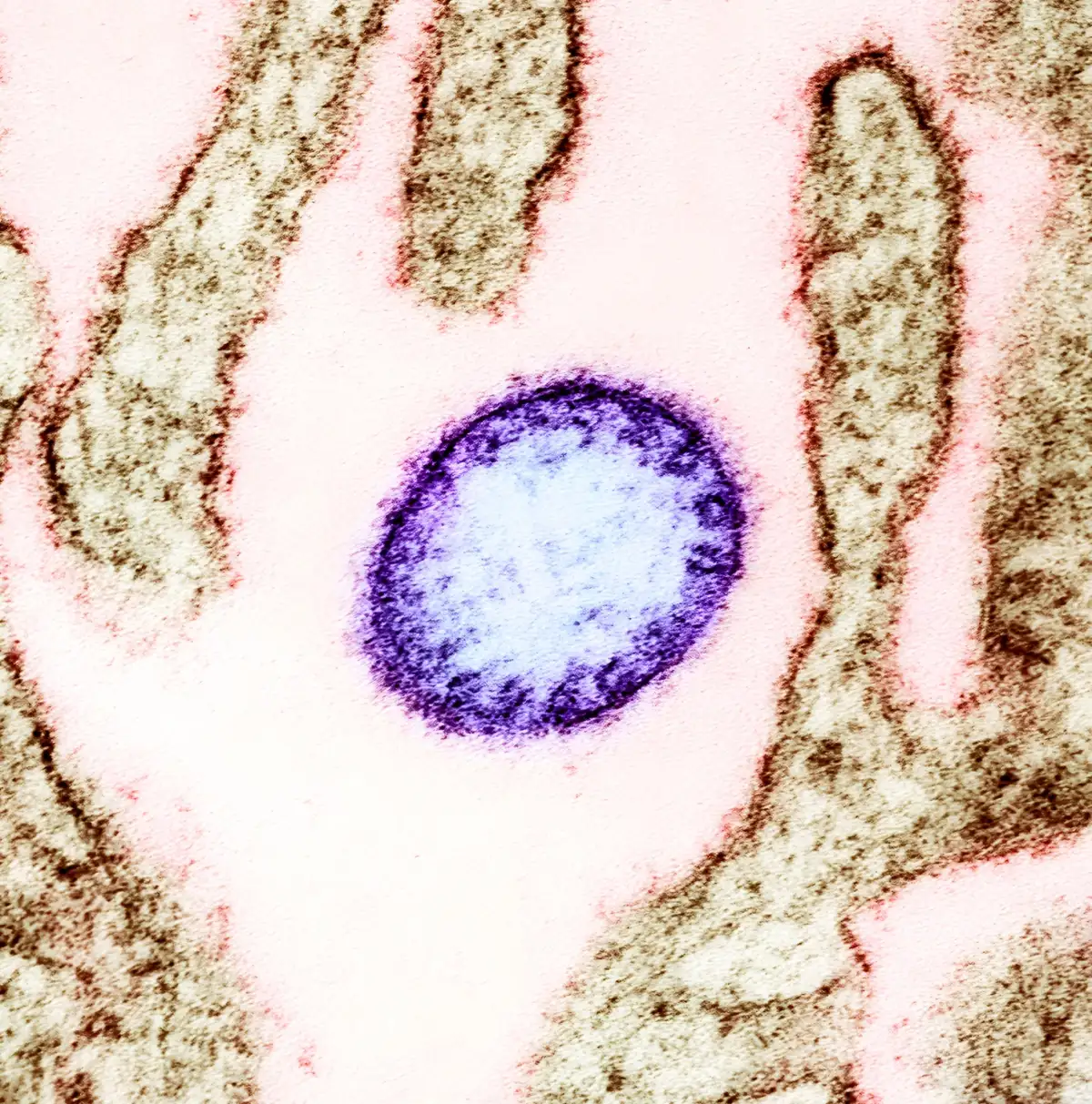 Virus Nipah Kembali Mewabah di India, Risiko Kematian Capai 75%