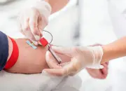 Tes Darah Baru Bisa Prediksi Peluang Umur Panjang Manusia dengan Akurasi 86%