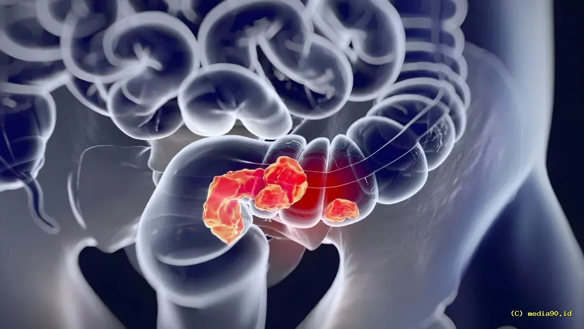Kanker Usus pada Usia Muda Meningkat, Peneliti Temukan Jejak Herbisida di DNA