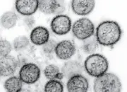 Empat Kasus Hantavirus Ditemukan di DKI, BRIN Imbau Masyarakat Tetap Waspada