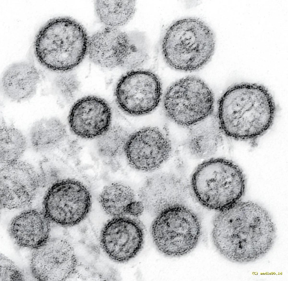 Badan Riset dan Inovasi Nasional Ungkap Risiko Penularan Hantavirus Usai Kasus Ditemukan di DKI Jakarta