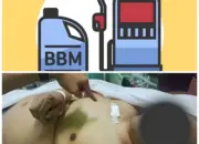 Viral! Diduga Dipicu Sengketa Antrean BBM, Pria Tewas Setelah Dikeroyok dan Alami 12 Luka Tusukan