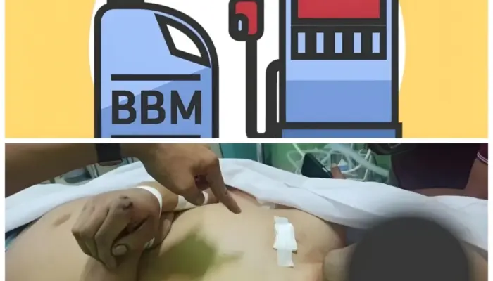Viral! Diduga Dipicu Sengketa Antrean BBM, Pria Tewas Setelah Dikeroyok dan Alami 12 Luka Tusukan