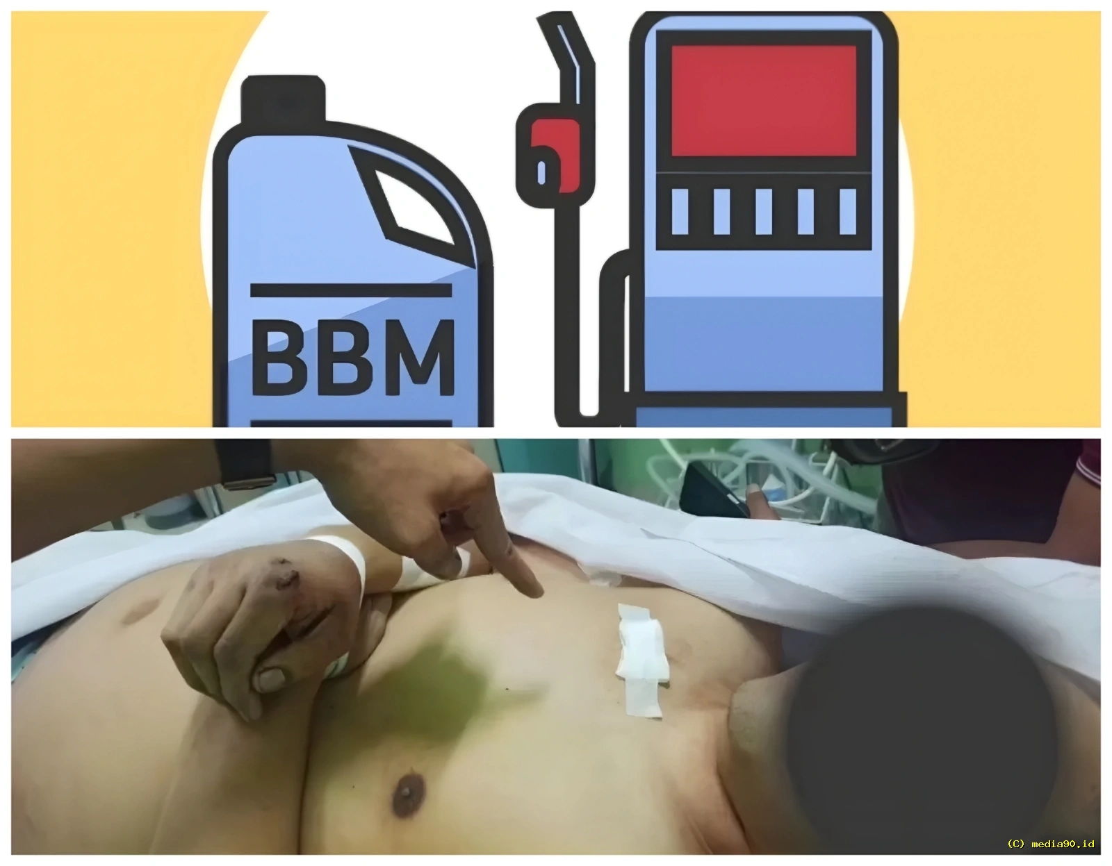 Tragis! Pria Tewas dengan 12 Luka Tusukan, Diduga Berawal dari Perselisihan Antrean BBM