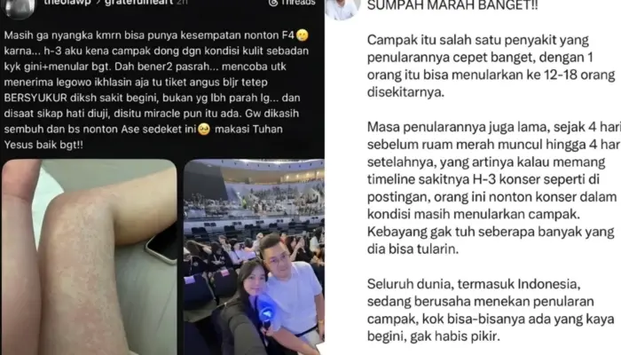 Tuai Kecaman! Penggemar F4 Akui Tetap Nonton Konser Meski Terkena Campak, Publik Soroti Risiko Penularan