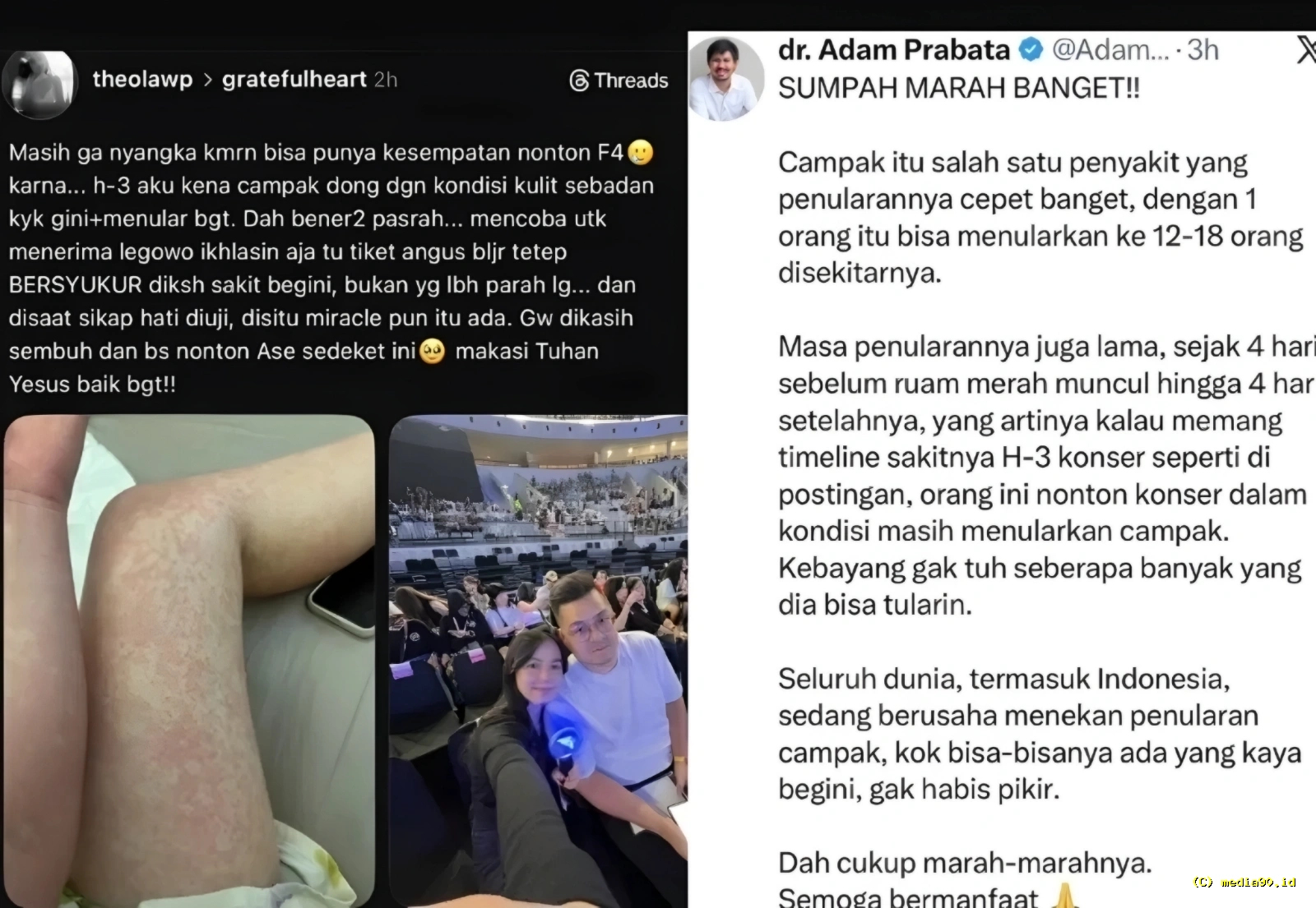 Viral! Penggemar F4 Tetap Hadiri Konser Meski Terinfeksi Campak, Tuai Kritik Publik